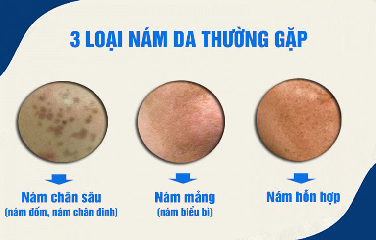 Cac loai nam da